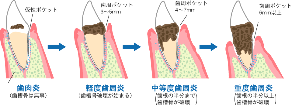 治療法